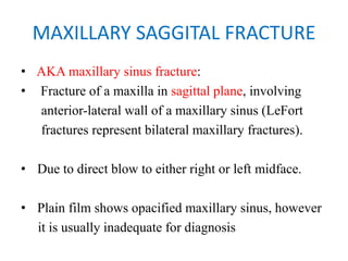 MAXILLARY SAGGITAL FRACTURE
• AKA maxillary sinus fracture:
•   Fracture of a maxilla in sagittal plane, involving
anterior-lateral wall of a maxillary sinus (LeFort
fractures represent bilateral maxillary fractures).
• Due to direct blow to either right or left midface.
• Plain film shows opacified maxillary sinus, however
it is usually inadequate for diagnosis
 