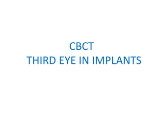 CBCT
THIRD EYE IN IMPLANTS
 