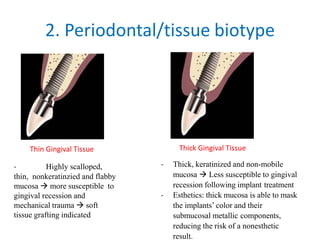2. Periodontal/tissue biotype
- Highly scalloped,
thin, nonkeratinzied and flabby
mucosa  more susceptible to
gingival recession and
mechanical trauma  soft
tissue grafting indicated
- Thick, keratinized and non-mobile
mucosa  Less susceptible to gingival
recession following implant treatment
- Esthetics: thick mucosa is able to mask
the implants’ color and their
submucosal metallic components,
reducing the risk of a nonesthetic
result.
Thin Gingival Tissue Thick Gingival Tissue
 