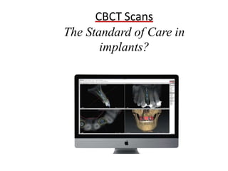 CBCT Scans
The Standard of Care in
implants?
 