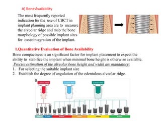 The most frequently reported
indication for the use of CBCT in
implant planning area are to measure
the alveolar ridge and map the bone
morphology of possible implant sites
for osseointegration of the implant.
A) BoneAvailability
1.Quantitative Evaluation of Bone Availability
Bone compactness is an significant factor for implant placement to expect the
ability to stabilize the implant when minimal bone height is otherwise available.
Precise estimation of the alveolar bone height and width are mandatory:
1. For selecting the suitable implant size
2. Establish the degree of angulation of the edentulous alveolar ridge.
0
 