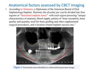 Anatomical factors assessed by CBCT imaging
• According to Tolstunov, a Diplomate of the American Board of Oral
Implantology/Implant Dentistry the alveolar jaw can be divided into four
regions or “functional implant zones” with each region posessing "unique
characteristics of anatomy, blood supply, pattern of bone resorption, bone
quality and quantity, need for bone grafting and other supplemental
surgical procedures, and a location related implant success rate.”
 