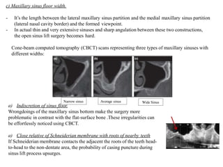 c) Maxillary sinus floor width.
- It’s the length between the lateral maxillary sinus partition and the medial maxillary sinus partition
(lateral nasal cavity border) and the formed viewpoint.
- In actual thin and very extensive sinuses and sharp angulation between these two constructions,
the open sinus lift surgery becomes hard.
Cone-beam computed tomography (CBCT) scans representing three types of maxillary sinuses with
different widths:
Narrow sinus Average sinus Wide Sinus
a) Indiscretion of sinus floor.
Wrongdoings of the maxillary sinus bottom make the surgery more
problematic in contrast with the flat-surface bone .These irregularities can
be effortlessly noticed using CBCT.
a) Close relative of Schneiderian membrane with roots of nearby teeth
If Schneiderian membrane contacts the adjacent the roots of the teeth head-
to-head to the non-dentate area, the probability of casing puncture during
sinus lift process upsurges.
 