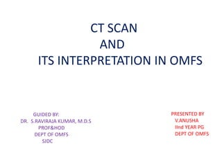 CT SCAN
AND
ITS INTERPRETATION IN OMFS
GUIDED BY:
DR. S.RAVIRAJA KUMAR, M.D.S
PROF&HOD
DEPT OF OMFS
SJDC
PRESENTED BY
V.ANUSHA
IInd YEAR PG
DEPT OF OMFS
 
