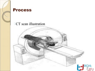 Process
CT scan illustration
 