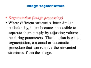 Image segmentation
• Segmentation (image processing)
• Where different structures have similar
radiodensity, it can become impossible to
separate them simply by adjusting volume
rendering parameters. The solution is called
segmentation, a manual or automatic
procedure that can remove the unwanted
structures from the image.
 