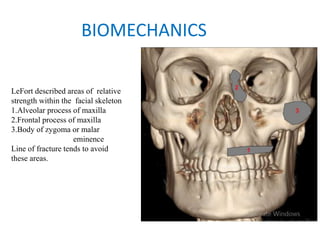 BIOMECHANICS
LeFort described areas of relative
strength within the facial skeleton
1.Alveolar process of maxilla
2.Frontal process of maxilla
3.Body of zygoma or malar
eminence
Line of fracture tends to avoid
these areas.
 
