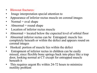 • Blowout fractures:
•   Image interpretation special attention to
• Appearance of inferior rectus muscle on coronal images
•   Normal = oval shape
•   Abnormal = round shape
•   Location of inferior rectus muscle
• Abnormal = located below the expected level of orbital floor
• Abnormal inferior rectus can be Entrapped: muscle lies
completely beneath or within the defect and appears round on
coronal images
• Hooked: portion of muscle lies within the defect
•   Entrapment of inferior rectus in children can be easily
missed, since flexible bone springs back into place like a trap
door, looking normal at CT except for entrapped muscle
beneath it
• This requires urgent Rx within 24-72 hours to minimize
motility problem .
 