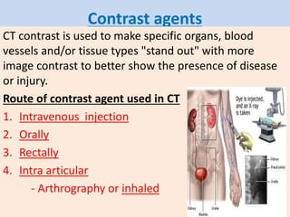 Contrast agents
CT contrast is used to make specific organs, blood
vessels and/or tissue types "stand out" with more
image contrast to better show the presence of disease
or injury.
Route of contrast agent used in CT
1. Intravenous injection
2. Orally
3. Rectally
4. Intra articular
- Arthrography or inhaled
 