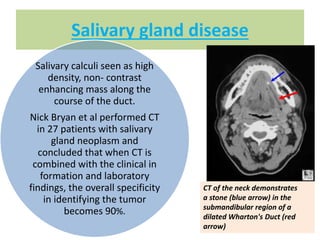 Salivary gland disease
Salivary calculi seen as high
density, non- contrast
enhancing mass along the
course of the duct.
Nick Bryan et al performed CT
in 27 patients with salivary
gland neoplasm and
concluded that when CT is
combined with the clinical in
formation and laboratory
findings, the overall specificity
in identifying the tumor
becomes 90%.
CT of the neck demonstrates
a stone (blue arrow) in the
submandibular region of a
dilated Wharton's Duct (red
arrow)
 