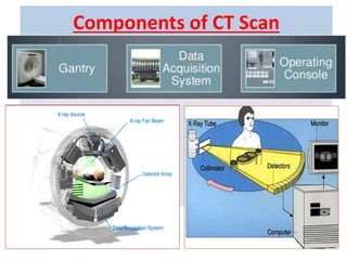 Components of CT Scan
Gantry
Data Acquisition System/computer
Operating Console
 