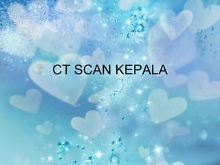 CT SCAN KEPALA
 