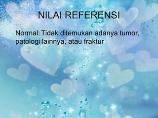 NILAI REFERENSI
Normal: Tidak ditemukan adanya tumor,
patologi lainnya, atau fraktur
 