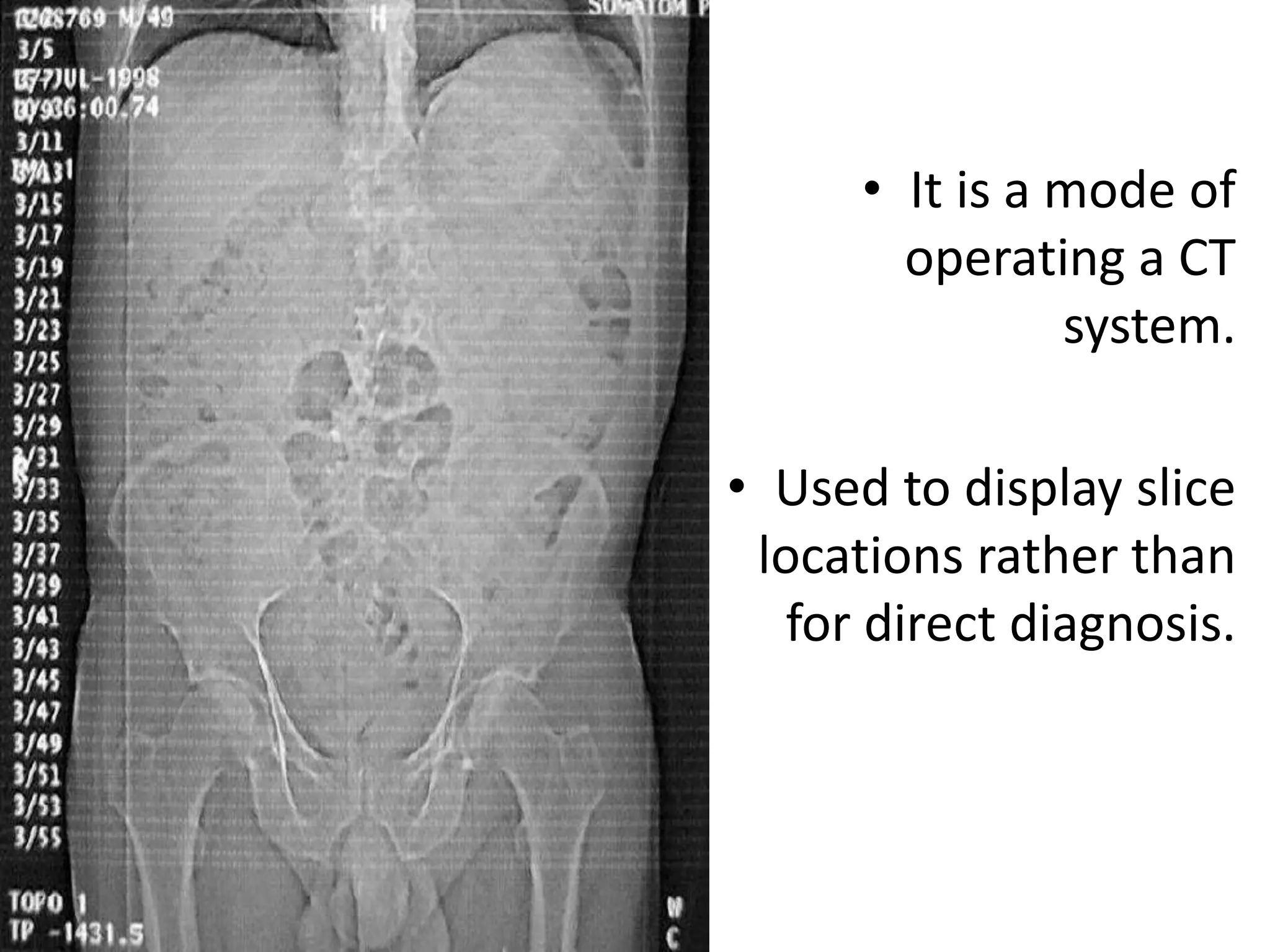 Abdominal CT scan made easy | PPTX