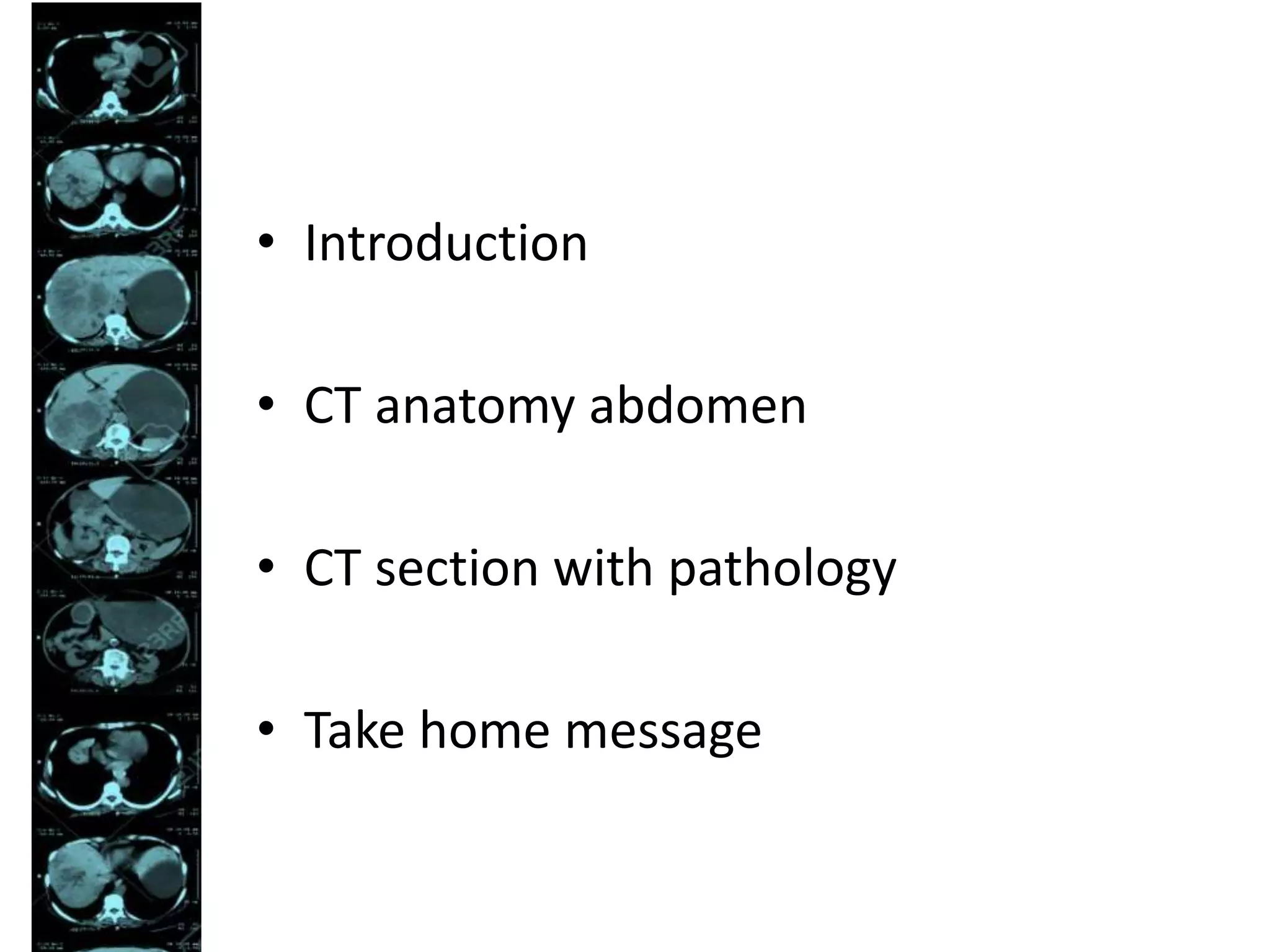 Abdominal CT scan made easy | PPTX