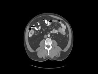 Abdominal CT scan made easy | PPTX