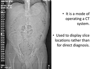 Abdominal CT scan made easy | PPTX