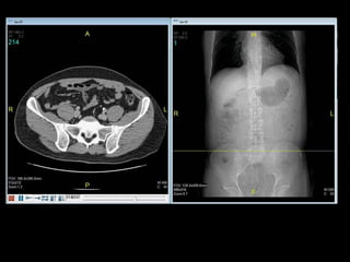 Abdominal CT scan made easy | PPTX