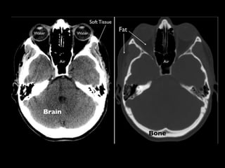 Abdominal CT scan made easy | PPTX