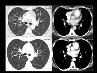 Abdominal CT scan made easy | PPTX