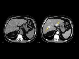 Abdominal CT scan made easy | PPTX