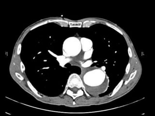 Abdominal CT scan made easy | PPTX