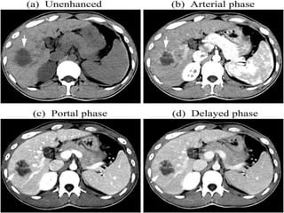 Abdominal CT scan made easy | PPTX