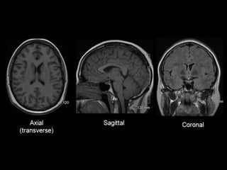 Abdominal CT scan made easy | PPTX