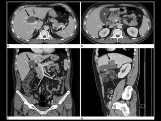 Abdominal CT scan made easy | PPTX