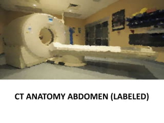 Abdominal CT scan made easy | PPTX