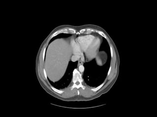 Abdominal CT scan made easy | PPTX