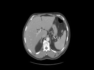 Abdominal CT scan made easy | PPTX