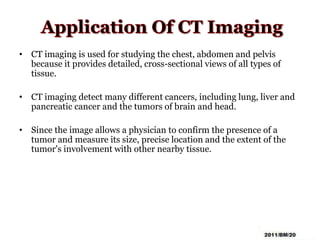 • CT imaging is used for studying the chest, abdomen and pelvis
because it provides detailed, cross-sectional views of all types of
tissue.
• CT imaging detect many different cancers, including lung, liver and
pancreatic cancer and the tumors of brain and head.
• Since the image allows a physician to confirm the presence of a
tumor and measure its size, precise location and the extent of the
tumor's involvement with other nearby tissue.
 