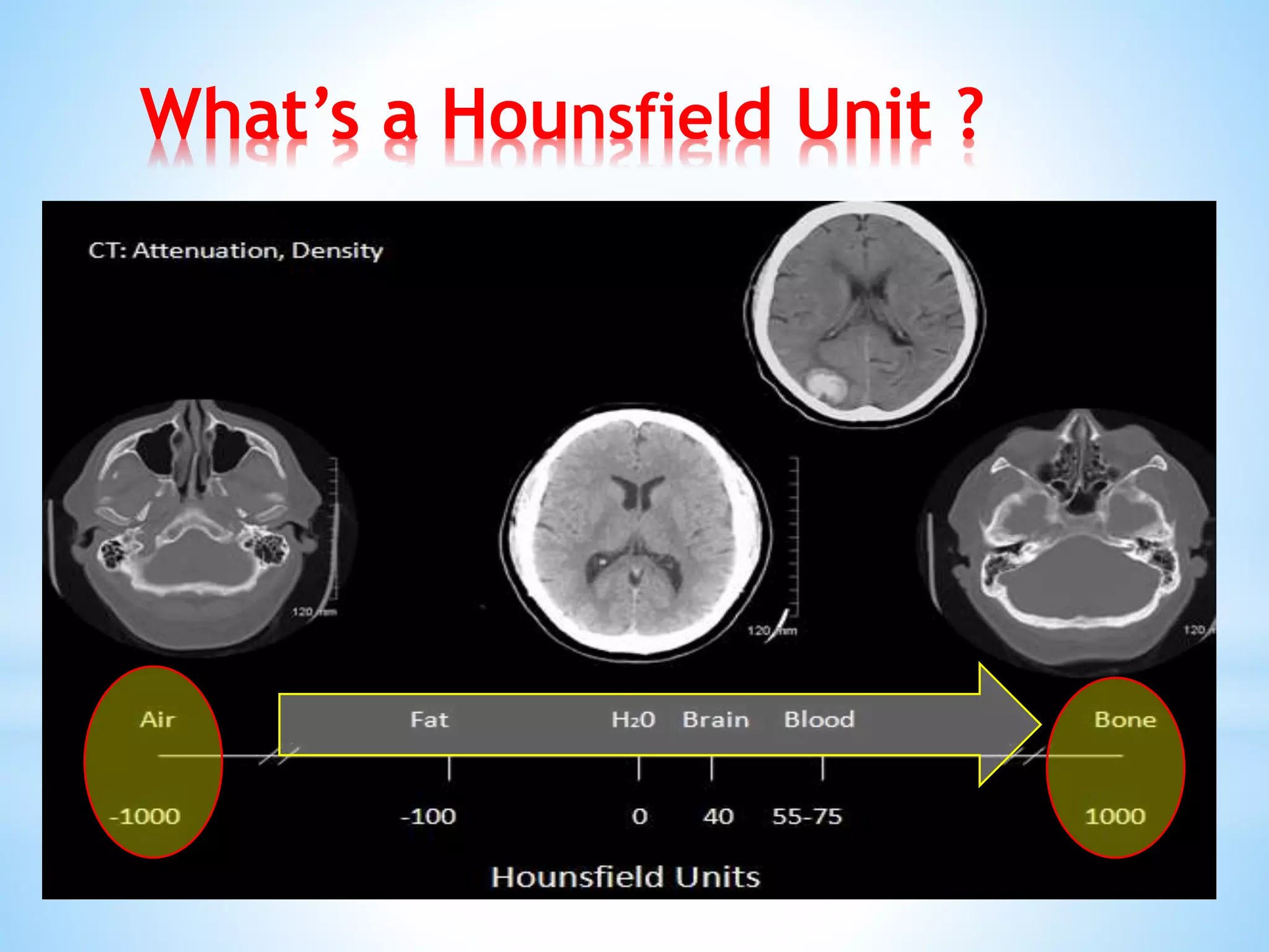 What’s a Hounsfield Unit ?
 