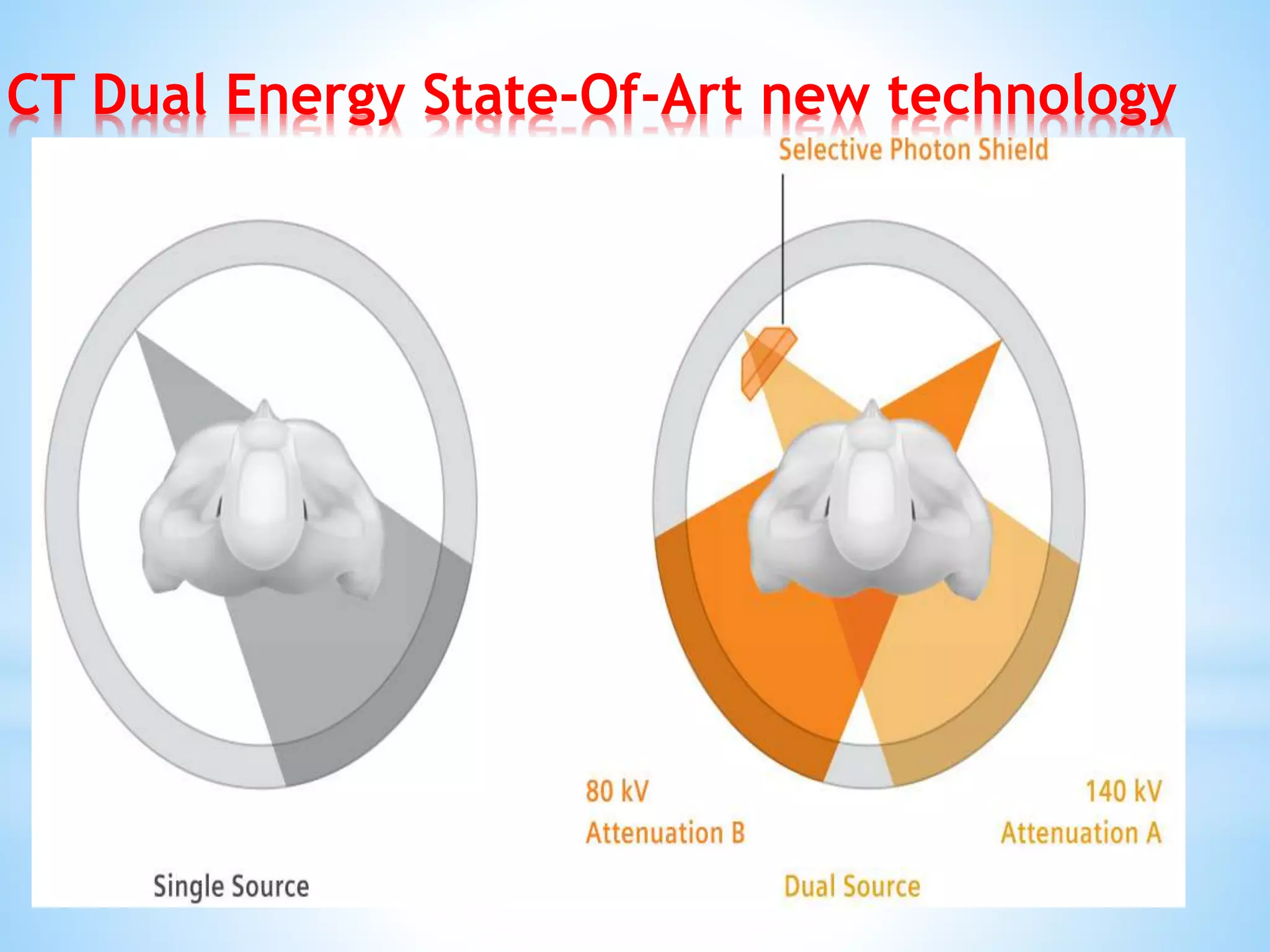 CT Dual Energy State-Of-Art new technology
 