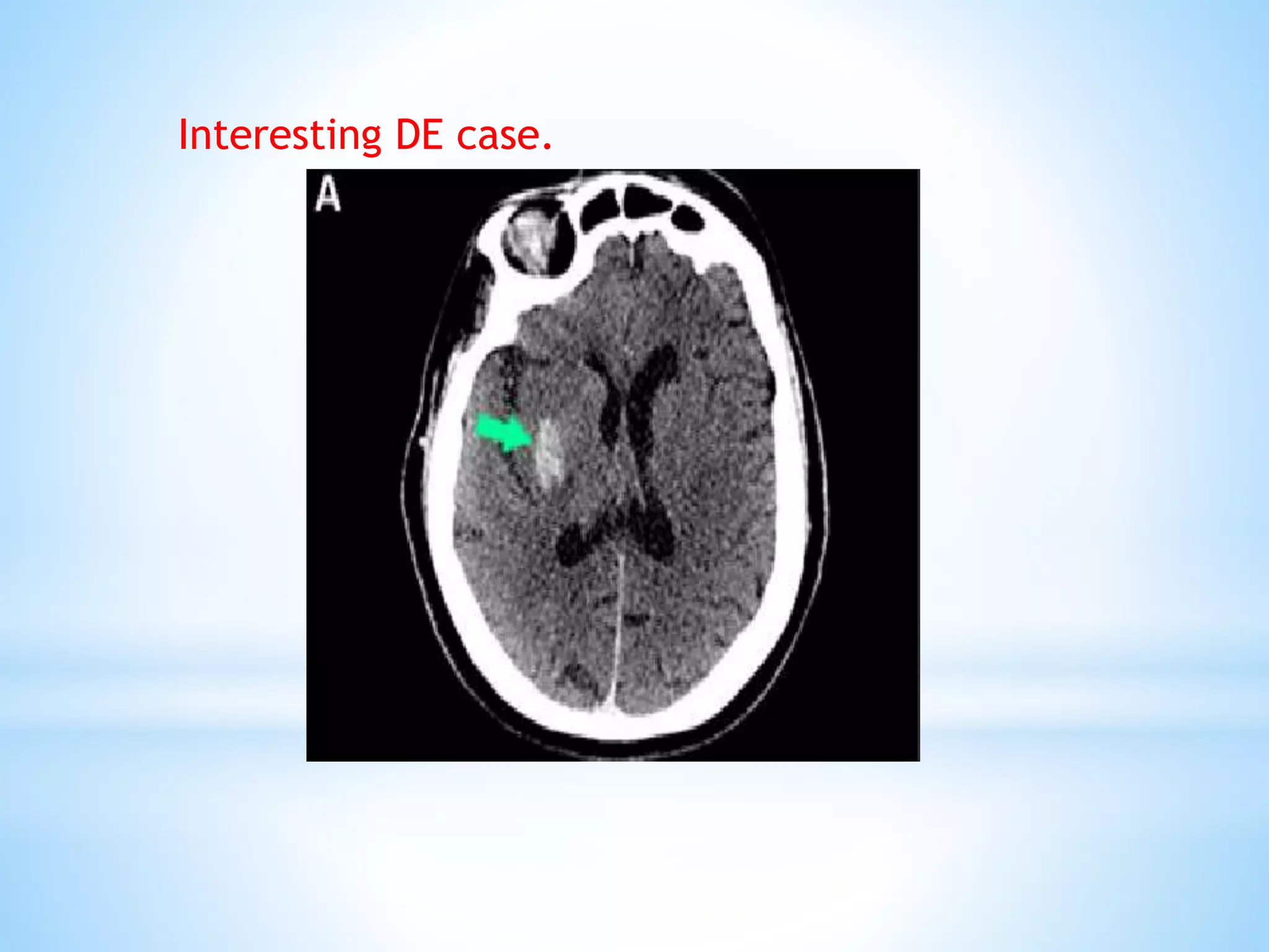 Interesting DE case.
 