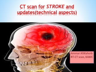 CT scan for STROKE and
updates(technical aspects)
 