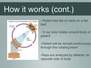How it works (cont.)
- Patient lies flat on back on a flat
bed
- X-ray tube rotates around body of
patient
-Patient will be moved continuously
through this rotating beam
-Rays are analyzed by detector on
opposite side of body

 