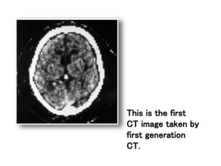 Computed Tomography (CT) scan is an advanced imaging technique that ...