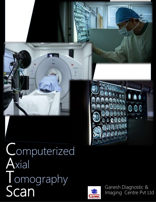 Computerized
Axial
Tomography
Scan
Ganesh Diagnostic &
Imaging Centre Pvt Ltd
 