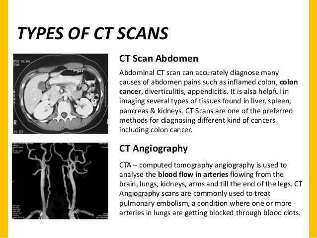 What Can A Cat Scan Detect What Can A Cat Scan Detect