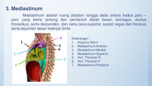 ppt aplikasi klinis Ctscan thorax pada kasus Corpus Alienum
