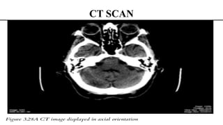 Computed tomography SCAN, ULTRASOUND, MRI.pptx slides | PPTX