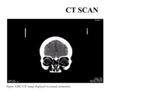 Computed tomography SCAN, ULTRASOUND, MRI.pptx slides | PPTX