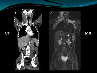 CT Scan Vs MRI Scan | PPTX