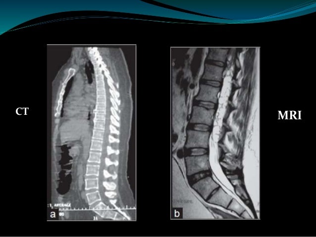 Ct Scan Vs Mri Scan