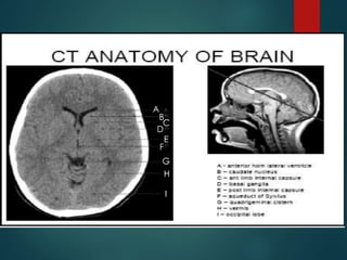 CT imaging of Brain in Clinical Practice by Dr. Vaibhav Yawalkar | PPTX