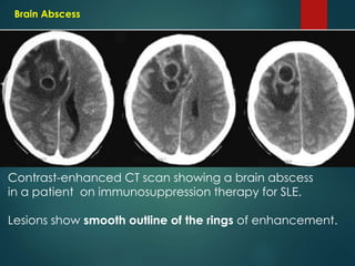 CT imaging of Brain in Clinical Practice by Dr. Vaibhav Yawalkar | PPTX