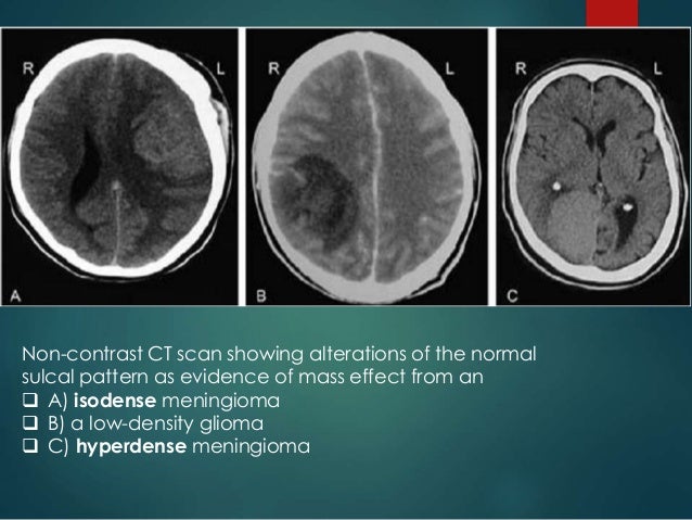 CT imaging of Brain in Clinical Practice by Dr. Vaibhav Yawalkar