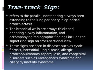 CT SIGNS IN CHESt for pulmonary medicine | PPTX